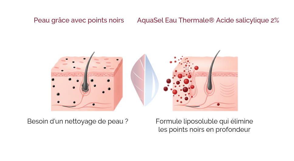 Anti-Acné (BHA 2%+Eau Thermale) anti acné (bha 2%+eau thermale)