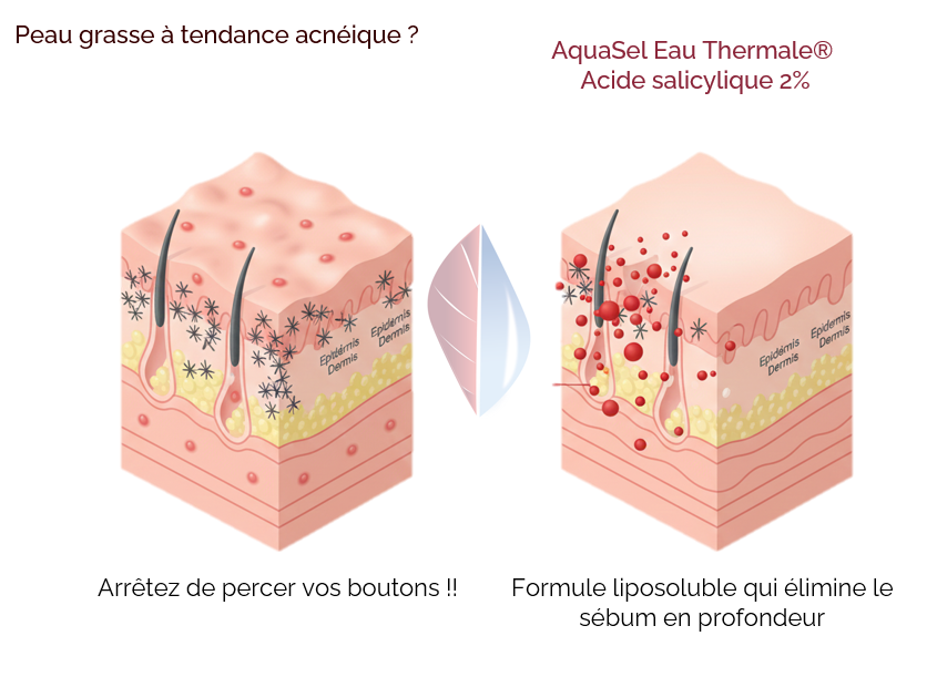 Anti-Acné (BHA 2%+Eau Thermale) anti acné (bha 2%+eau thermale)